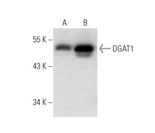 western blotting image from recommended DGAT1 (A-5) monoclonal antibody replacement. Image 303822