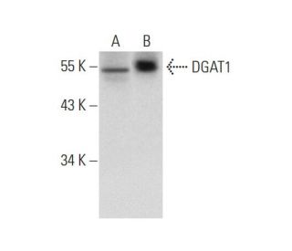 DGAT1 Antibody (A-5) - Western Blotting - Image 134546