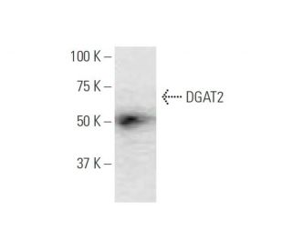 DGAT2 Antibody (4C1) - Western Blotting - Image 347631The Double Nickase Plasmid features a U6 promoter for sgRNA expression, a 20 nt targeting sequence, and a gRNA scaffold to guide Cas9n. It includes a CBh promoter for Cas9n (D10A) and puromycin resistance, GFP for transfection verification, and nuclear localization signals (NLS). The 2A peptide allows co-expression of Cas9n and Puro from a single promoter, enabling precise genome editing with reduced off-target effects.