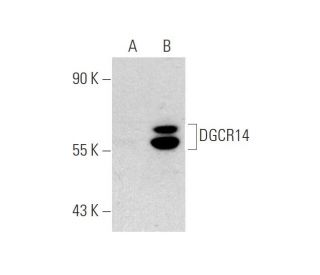 DGCR14 Antibody (2264C3a) - Western Blotting - Image 65628 