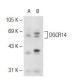 DGCR14 Antibody (2264C3a) - Western Blotting - Image 109356 