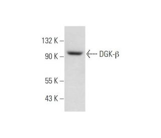 DGK-&beta; Antibody (G-11) - Western Blotting - Image 344111 