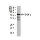 DGK-ε Antibody (AA9) - Western Blotting - Image 33746