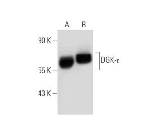 DGK-&epsilon; Antibody (AA9) - Western Blotting - Image 137597 