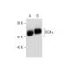 DGK-ε Antibody (AA9) - Western Blotting - Image 137597 