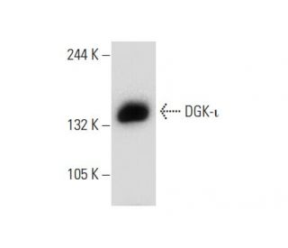 DGK-&iota; Antibody (D-4) - Western Blotting - Image 133965Each CRISPR/Cas9 Knockout (KO) Plasmid product consists of a pool of 3 plasmids designed to ensure identification and cleavage of a specific gene for maximum knockout efficiency. Each plasmid encodes a unique 20 nt sequence derived from the GeCKO (v2) library. 
