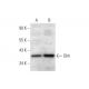 western blotting image from recommended Dhh (F-9) monoclonal antibody replacement. Image 297848