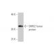 DHRS2 Antibody (1F10) - Western Blotting - Image 349017