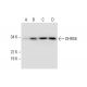 DHRS6 Antibody (H-5) - Western Blotting - Image 291910