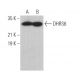 DHRS6 Antibody (H-5) - Western Blotting - Image 374396 