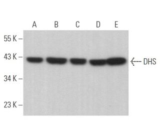 DHS Antibody (A-10) - Western Blotting - Image 375001 