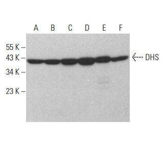 DHS Antibody (A-10) - Western Blotting - Image 383907