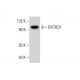 DHTKD1 Antibody (F-11) - Western Blotting - Image 306558 