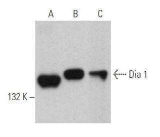 western blotting image from recommended Dia 1 (E-4) monoclonal antibody replacement. Image 362377
