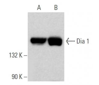Dia 1 Antibody (E-4) - Western Blotting - Image 362371 
