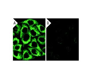 Dia 1 siRNA (h): sc-35190. Immunofluorescence staining of methanol-fixed, control HeLa (A) and Dia 1 siRNA silenced HeLa ( 