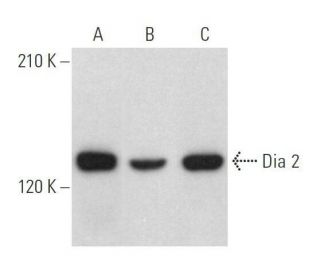 Dia 2 Antibody (C-12) - Western Blotting - Image 358898 