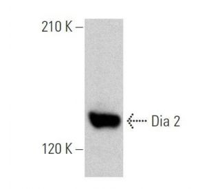 Dia 2 Antibody (C-7) - Western Blotting - Image 358895 