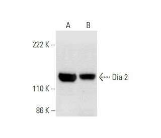 Dia 2 Antibody (H-3) - Western Blotting - Image 295970 