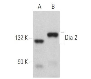 Dia 2 Antibody (C-7) - Western Blotting - Image 365150 