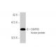 DIAPH3 Antibody (4D5) - Western Blotting - Image 350280