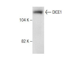 DICE1 Antibody (H-6): sc-376524