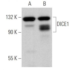 DICE1 Antibody (H-6) - Western Blotting - Image 367222 