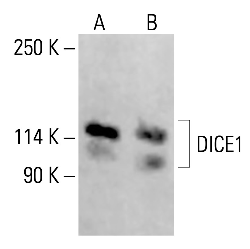DICE1 Antibody (H-6) | SCBT - Santa Cruz Biotechnology