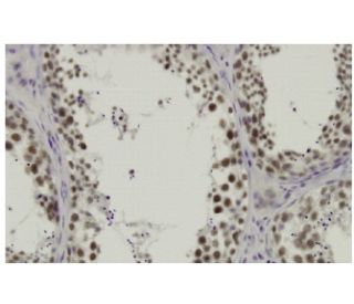 DICE1 Antibody (LL7) - Immunohistochemistry - Image 36349