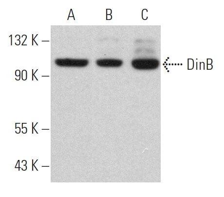 【お気に入り】 DinB Antibody (A-9) | SCBT - Santa Cruz Biotechnology ラケット(軟式用)