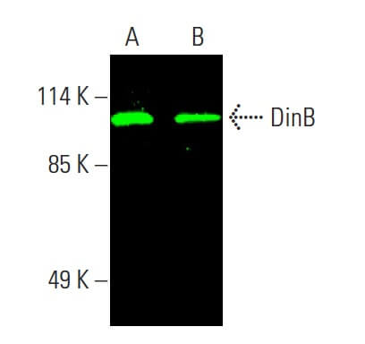 【お買得】 Antibody DinB (A-9) Biotechnology Cruz Santa - SCBT | ラケット(軟式用)
