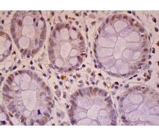 Dio-1 Antibody (B-9) - Immunohistochemistry - Image 289201 