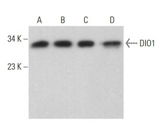 DIO1 Antibody (B-7) - Western Blotting - Image 376684 
