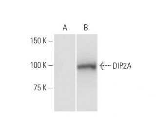 DIP2A Antibody (4E6) - Western Blotting - Image 347613 