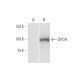 DIP2A Antibody (4E6) - Western Blotting - Image 347613 