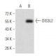 DIS3L2 Antibody (6C7B2) - Western Blotting - Image 358308