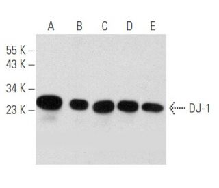 DJ-1 Antibody (m&alpha;DJ-1/E2-29) - Western Blotting - Image 354713 
