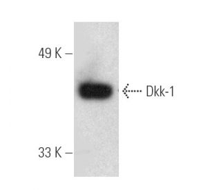 western blotting image from recommended Dkk-1 (B-7) monoclonal antibody replacement. Image 389391