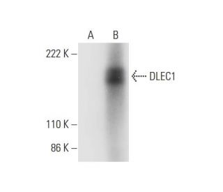 DLEC1 Antibody (C-1) - Western Blotting - Image 295740 
