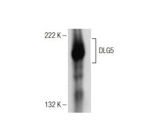 DLG5 Antibody (E-11) - Western Blotting - Image 151056