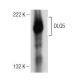 DLG5 Antibody (E-11) - Western Blotting - Image 151056
