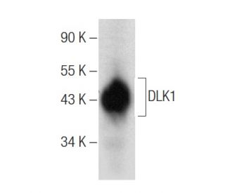 DLK1 Antibody (B-7) | SCBT - Santa Cruz Biotechnology