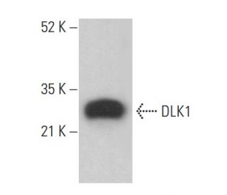 DLK1 Antibody (B-7) | SCBT - Santa Cruz Biotechnology