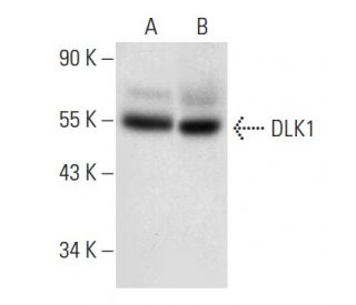 western blotting image from recommended DLK1 (B-7) monoclonal antibody replacement. Image 301276