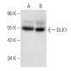 western blotting image from recommended DLK1 (B-7) monoclonal antibody replacement. Image 301276