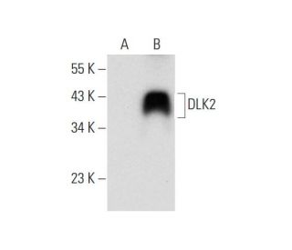 DLK2 Antibody (D-5) - Western Blotting - Image 314480