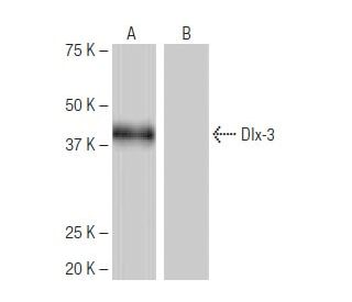 Dlx-3 Antibody (3-RE45) - Western Blotting - Image 64911Each CRISPR/Cas9 Knockout (KO) Plasmid product consists of a pool of 3 plasmids designed to ensure identification and cleavage of a specific gene for maximum knockout efficiency. Each plasmid encodes a unique 20 nt sequence derived from the GeCKO (v2) library.