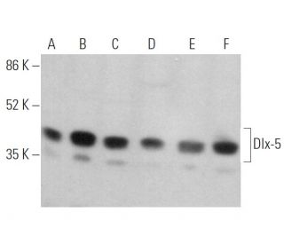 western blotting image from recommended Dlx-5 (H-4) monoclonal antibody replacement. Image 374366