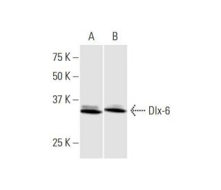 Dlx-6 Antibody (2D7) - Western Blotting - Image 352107 