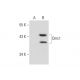 Dmc1 Antibody (2H12/4) - Western Blotting - Image 135141